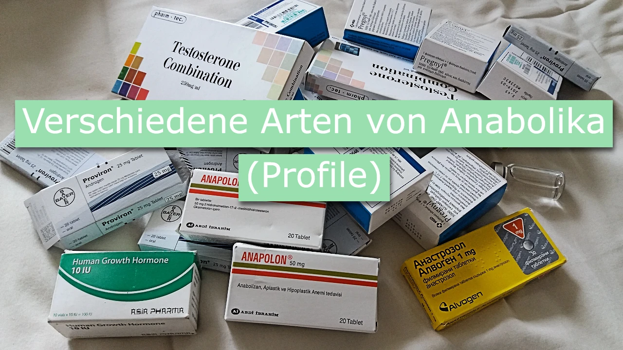 Masto E: Vorteile und Nachteile im Überblick